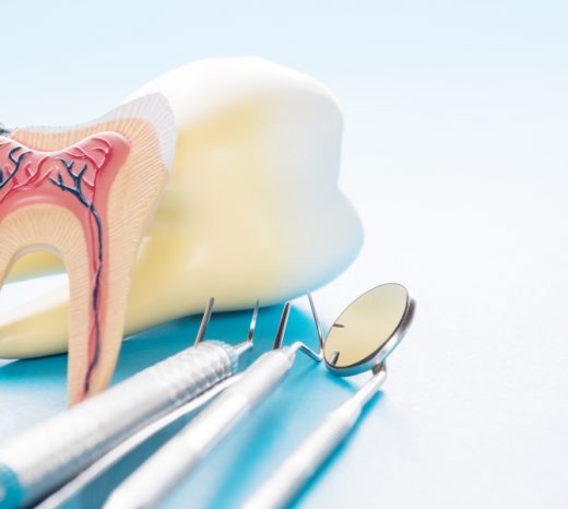 Dental Treament Root Canal Treatment